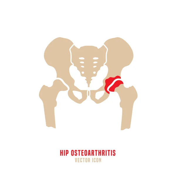 Osteoartritis de cadera Icono — Vector de stock