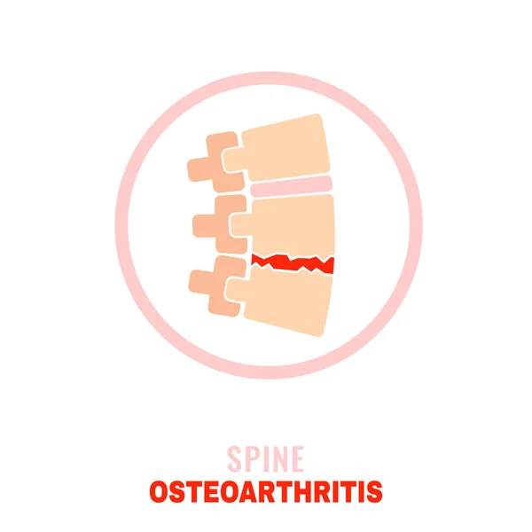 Wervelkolom osteoartritis pictogram — Stockvector