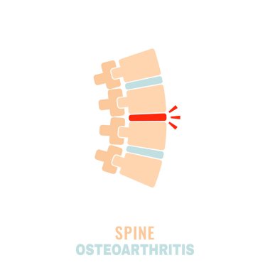 Omurga osteoartrit ikonu
