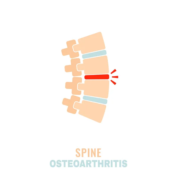 Εικονίδιο οστεοαρθρίτιδας σπονδυλικής στήλης — Διανυσματικό Αρχείο
