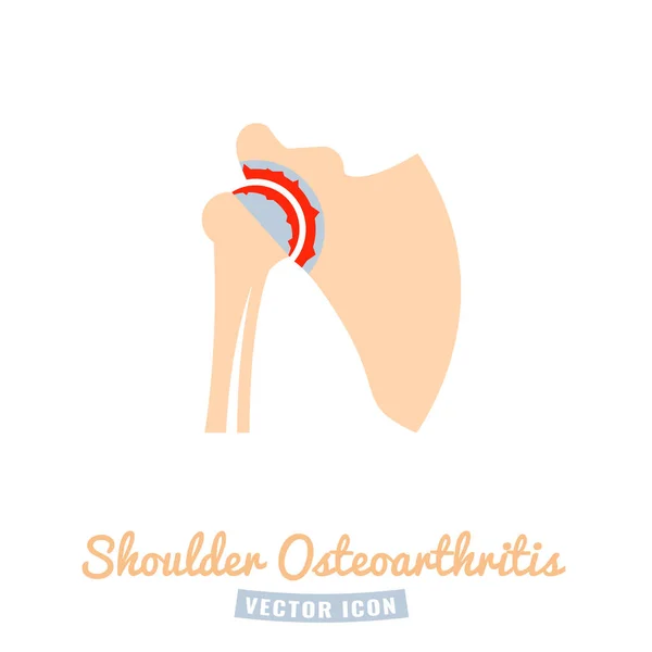 Schouder osteoartritis pictogram — Stockvector