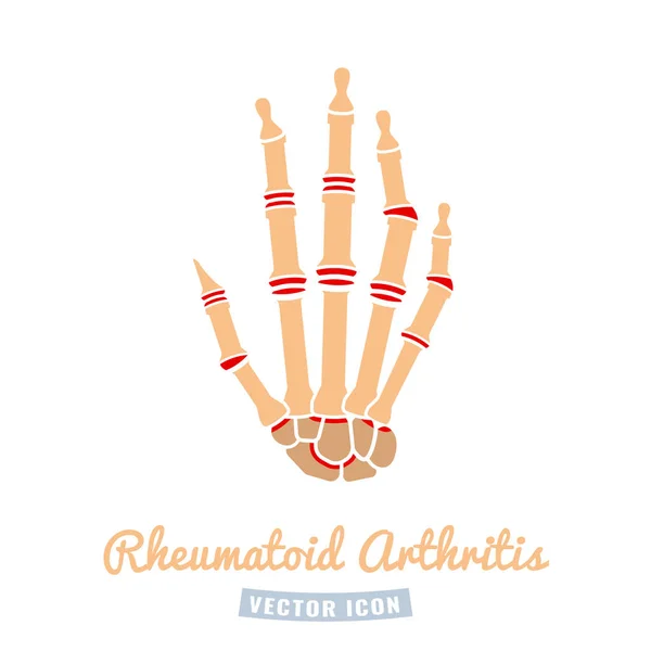 Pictogram reumatoïde artritis — Stockvector