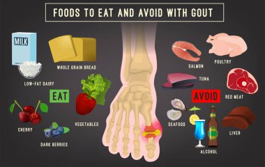 Gut artriti infografik