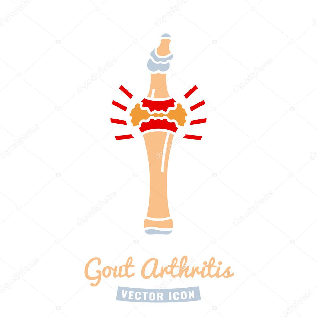Gout arthritis icon. Joint pain in human foot sign. Editable vector illustration in beige, grey and red colors isolated on white background. Modern flat style. Graphic design
