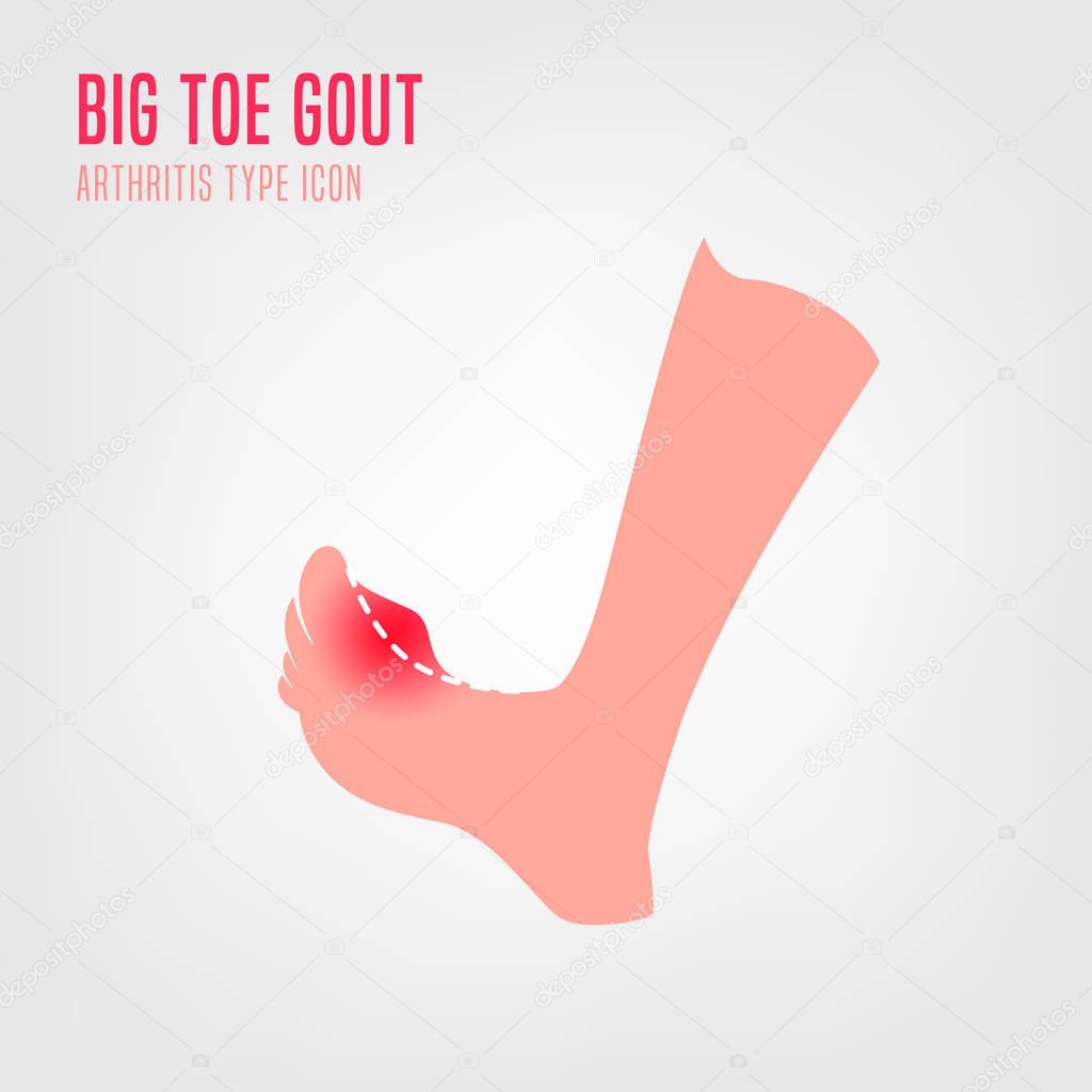 Gout arthritis icon. Joint pain in human foot sign. Editable vector illustration in pink and red colors isolated on white background. Modern flat style. Graphic design
