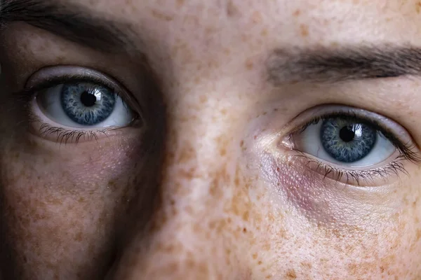 Cara de menina com sardas. Olhos azuis de uma menina close-up — Fotografia de Stock