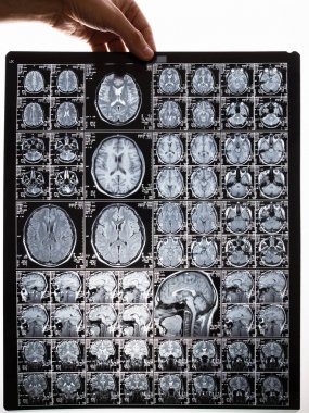 MRI beyin görüntü taraması. Elinde bir resim tutuyor