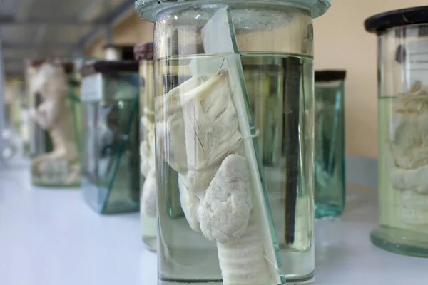 Human Anatomy. Wet specimens part of the human body. Medical science