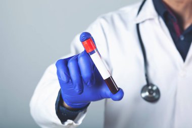 Genç doktor elinde kırmızı ilaç bulunan ampulü gri renkte tutuyor.