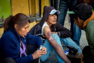 La Paz / Bolivya - 25 Kasım 2014: Genç Esmer Kadın Yüzünde Yaralar Olan Genç Yerli Ayakkabı Boyacısının Kolunda Yaraları İyileştiriyor