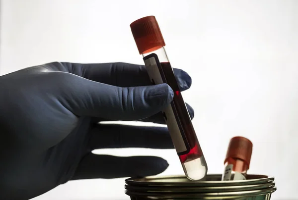 Doctor holds blood sample at a hospital table, conceptual image