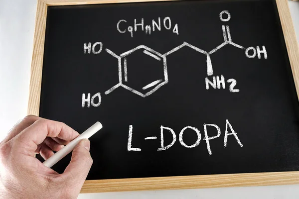 Fórmula Química Nomenclatura Dopa Manuscrito Com Giz Quadro Negro Imagem — Fotografia de Stock