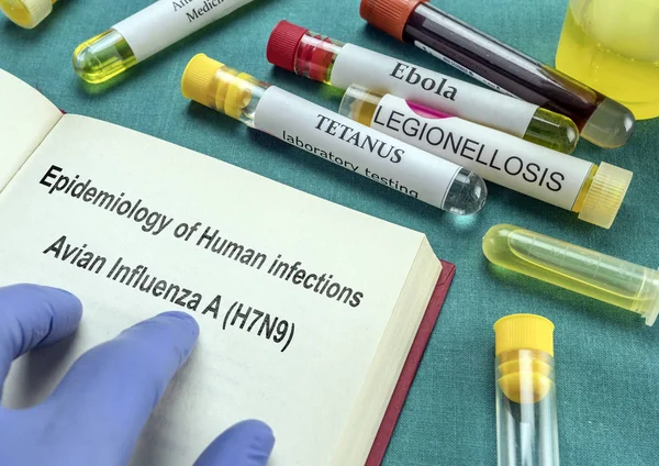 人間の疫学と感染症鳥インフルエンザ H7N9 現在の Metaforica 画像の医学書のページ — ストック写真