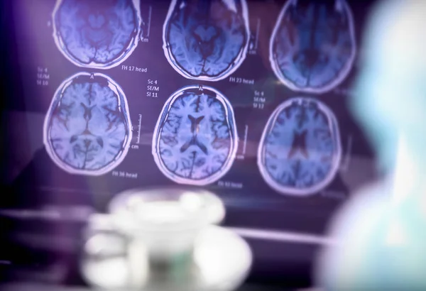 Hastanede Alzheimer hastalığının bilimsel analizi, kavramsal görüntü