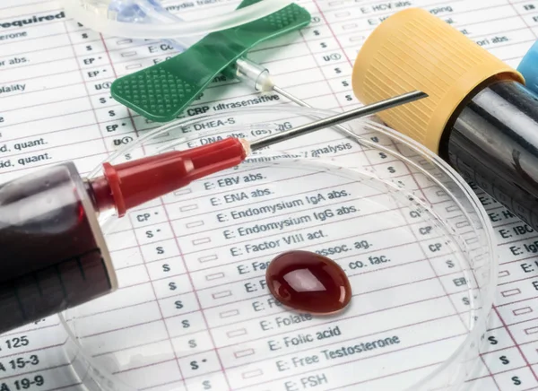 실험실, 개념적 이미지에서에서 주사기와 페 트리 디스크에 혈액 샘플 — 스톡 사진