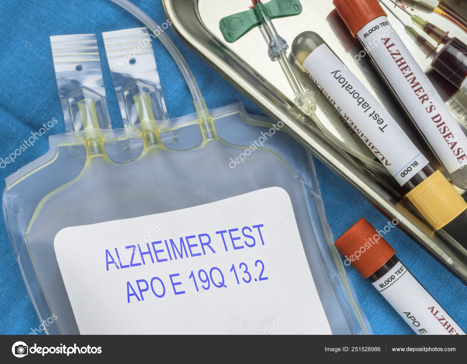 Test of Alzheimer disease through extraction of blood, Recent discovery