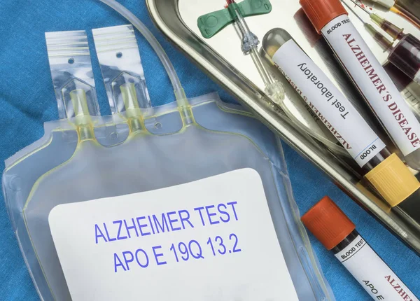 Test Alzheimerovy choroby extrakcí krve, nedávný objev umožňuje zjistit s 16 lety tuto nemoc, konceptuální image — Stock fotografie
