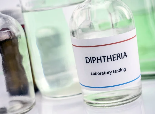 Teste de difteria em laboratório, imagem conceitual, composição horizontal — Fotografia de Stock