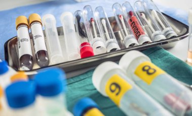  Criminalistic Lab cam şişeden kan örneği, kavramsal görüntü