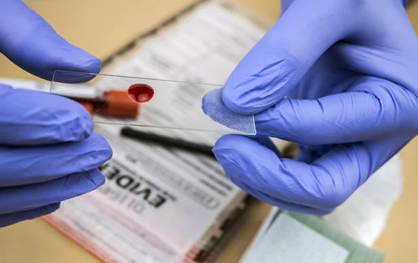 Specializované policejní odběr ukazuje krev v držáku mikroskopu analyzovat ve vědecké laboratoři, koncepční obraz — Stock fotografie
