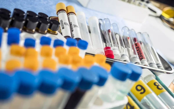 Diferentes amostras de cabelo e sangue para analisar no laboratório imagem científica, conceitual — Fotografia de Stock