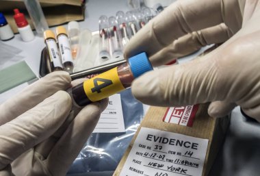 Polis uzmanı Criminalistic Lab, kavramsal görüntü cam şişe kan örneği alır