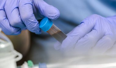 Hemşire hastanede kan örneği alıyor, kavramsal görüntü