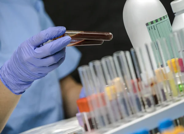 Enfermeira tira amostras de sangue em um hospital, imagem conceitual — Fotografia de Stock