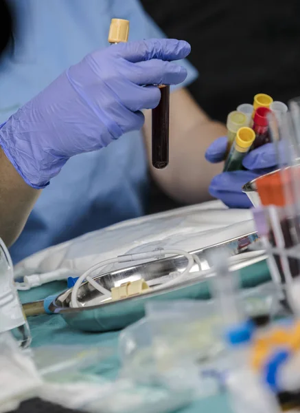 Doctor holds vial of blood sample in a hospital, conceptual image — Stock Photo, Image