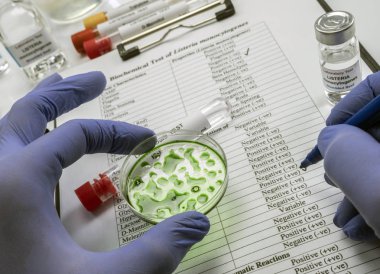Uzman laboratuvarda listeria bakterisi tarafından kontamine doldurulmuş et analizleri, İspanya'da neden filiz