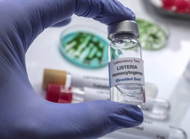 Uzman laboratuvarda listeria bakterisi tarafından kontamine doldurulmuş et analizleri, İspanya'da neden filiz