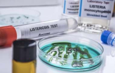 Laboratuvarda listeria bakterisi tarafından kirletilmiş, İspanya 'da filizlenen doldurulmuş et örneklerini analiz ediyorsunuz.