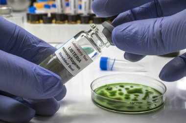 Uzman laboratuvarda listeria bakterisi tarafından kontamine doldurulmuş et analizleri, İspanya'da neden filiz