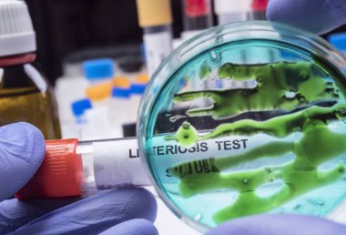 Uzman laboratuvarda listeria bakterisi tarafından kontamine doldurulmuş et analizleri, İspanya'da neden filiz