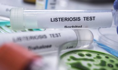 Laboratuvarda listeria bakterisi tarafından kirletilmiş, İspanya 'da filizlenen doldurulmuş et örneklerini analiz ediyorsunuz.