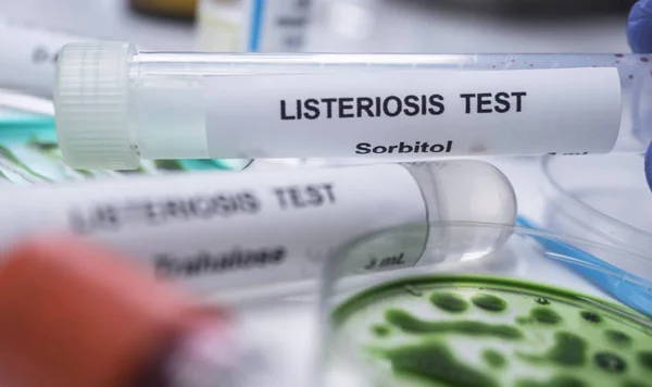 Monsters die je analyseert van gevuld vlees besmet met listeria bacterie in het laboratorium, kiemen veroorzaakt in Spanje — Stockfoto