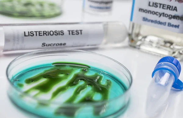 Amostras que você analisa de carne recheada contaminada por bactéria da listeria em laboratório, broto causado na Espanha — Fotografia de Stock