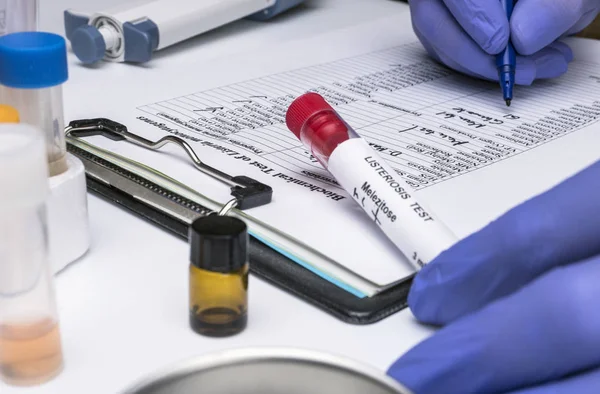 Scientist analyzes listeria sample in laboratory, conceptual image — Stock Photo, Image