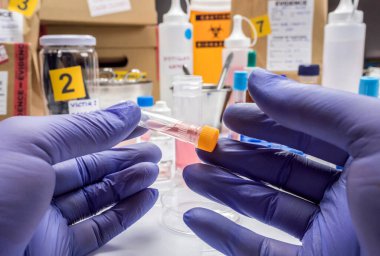 Uzman kriminalist polis, adli tıp test kiti ile bir suç laboratuarında hematolojik analiz gerçekleştiriyor.