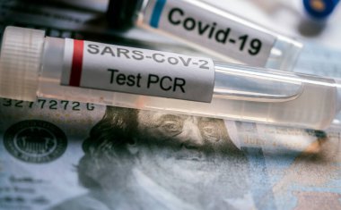 Amerikan banknotları üzerinde koronavirüs şişesi, kavramsal görüntü