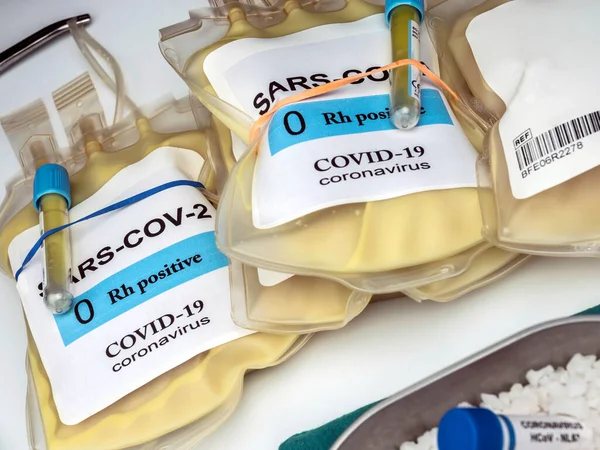 Плазма Антитілами Від Людей Вилікуваних Від Sars Cov Covid Приготованих — стокове фото