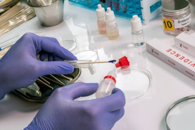 Suç laboratuarındaki bir cinayet için adli tıp test kiti ile yapılan hematolojik analizde insan kanı ve kavramsal görüntü pozitif çıktı.