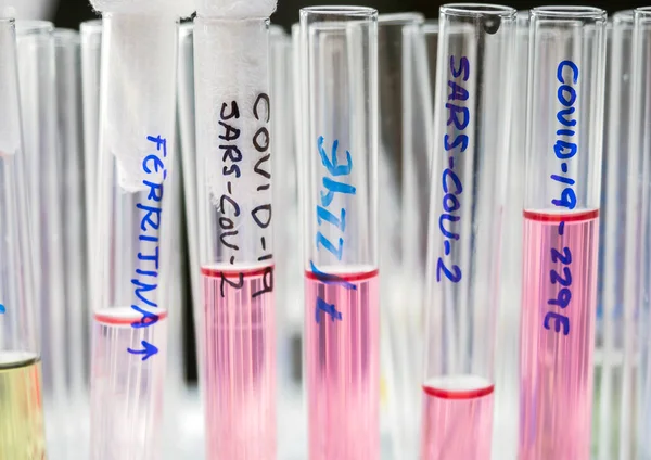 Vials Samples Sars Cov Prepared Cold Laboratory Epiedomological Study Sars — Stock Photo, Image