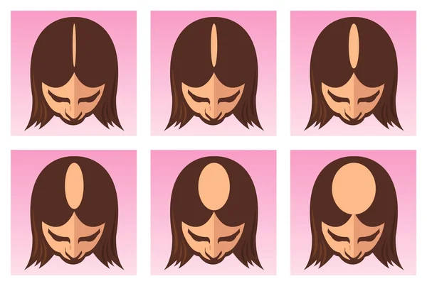 女性脱毛症ポスターの段階 — ストックベクタ