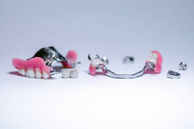 ortopedik dişçilik. Diş protezlerinin türleri