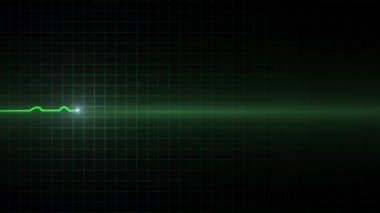 Ekg izleme kardiyogram