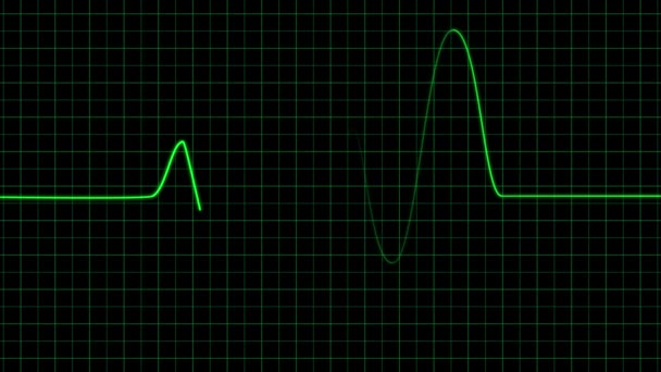 3D render, heartbeat frequency on heart line monitor recording pulse. —  Stock Video © KinoMasterDnepr #278036532