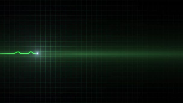 EKG monitoring kardiogram — Stock videók