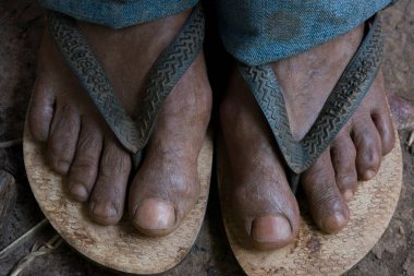 Salto de Pirapora, Sao Paulo, Brezilya - 24 Aralık 2015: Quilombo Cafundo 'dan kıdemli bir quilombola adamının ayakları, yaklaşık 80 nüfuslu bir Afro Brezilya topluluğu.