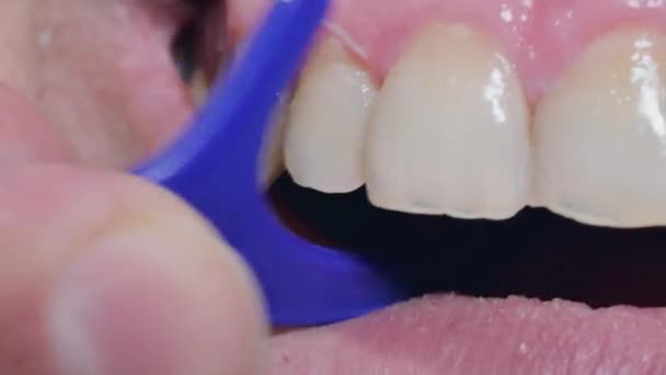 Макросъемка Процесса Чистки Зубов Помощью Специальной Зубочистки Зубной Нитью Предотвращения — стоковое видео
